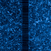 <span class=heading><b>The Brain Untangled</b> by Graham Robertson</span><br />This is a picture of human neurons, showing hair-like processes that the cells use to
communicate with each other. These come from induced pluripotent stem cells, which means
they started as a different cell type in a patient, and were transformed into neurons that we can
study under a microscope. We use these cells as a tool for understanding how brain disorders
occur and to try and find treatments for diseases.<br /><span class=small>Image: © 2016 Graham Robertson</span>.  <span class=small>Collaborators: The cells were provided by Dr Selina Wray and Teresa Sposito from University College London, and the project is supervised at Strathclyde University by Dr Michele Zagnoni and Dr Trevor Bushell.</span>