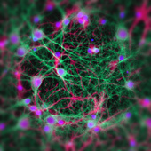 <span class=heading><b>The Brain in Focus</b> by Graham Robertson</span><br />The brain is an amazingly complex organ with billions of cells working together. Each neuron (the branching green cells) is connected to thousands of other neurons forming an organised network that they can communicate across. Our research involves growing these cells in a lab and focussing on how they change during injury and disease. By understanding these changes, we are better able to design new therapies to tackle these disorders.<br /><span class=small>Image: © 2017 Graham Robertson</span>.  <span class=small>Collaborators: Cells were provided by Christopher MacKerron</span>