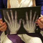 <span class=heading><b>Protecting the next generation</b> by Kirsty Ross</span><br />How do we protect future generations from the pain, joint destruction and premature death due to rheumatoid arthritis? In this image, my daughter Isla and I hold an X-ray of my father’s arthritic hands. I want to understand when, where, how and why arthritis is triggered. This research will hopefully enable the development of new treatments to cure or even prevent the disease starting in the first place!<br /><span class=small>Image: © 2015 Kirsty Ross</span>.  <span class=small>Collaborators: Dr Catherine Lawrence, Professor Iain McInnes, Isla Hutchison, Steven Hutchison</span>