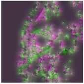 <span class=heading><b>Visualising the Road to Recovery</b> by Ivan Shorokhov</span><br />Heart attacks are a major cause of death in modern society, affecting
more than 3 million people annually. This research focusses on
producing 3D visualisations of the heart, to assist accurate damage
diagnosis and therapy planning. Here you see images extracted from
a movie of a patient’s heartbeat, overlaid with each other and with
arrows indicating movement. This information is then used to develop
the final 3D visualisation.<br /><span class=small>Image: © 2016 Ivan Shorokhov</span>.  <span class=small>Collaborators: Prof John J. Soraghan</span>
