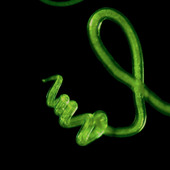 <span class=heading><b>Parasites: Friend or Foe?</b> by James Doonan</span><br />Like it or not, parasites and humans have co-evolved over millennia. As we work to improve sanitation and eradicate parasites, should we first ask ourselves whether this living arrangement has actually protected our immune systems by preventing the rise of autoimmune diseases, like rheumatoid arthritis? Our research is investigating whether a protein produced by parasitic worms could be used to create new and better medicines to treat autoimmune diseases. <br /><span class=small>Image: © 2017 James Doonan</span>.  <span class=small>Collaborators: Dr Felicity Lumb - Co-creator of content.</span>