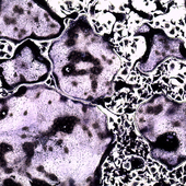 <div><div style="float:left;padding-left:5px;width:70%"><span class=heading><b>Formation of Bone-Eroding Cells</b> by James Doonan</span><br />Inflammatory, bone-eroding cells are responsible for the
destruction of bone in diseases like Rheumatoid arthritis.
Inflammatory diseases lead to increased formation of these
bone-eroding cells that ultimately result in disability. Our
lab is focusing on using drug-like compounds to reduce
inflammation during disease to stop the loss of bone by
preventing these cells from getting the inflammatory signals
that lead to increased bone erosion.<br /><span class=small>Image: © 2016 James Doonan</span></div><div style="float:right;padding-right:5px;"><iframe width="280" height="170" src="https://www.youtube.com/embed/10oHz_MgOzQ" frameborder="0" allowfullscreen></iframe></div></div>