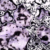 <div><div style="float:left;padding-left:5px;width:70%"><span class=heading><b>Formation of Bone-Eroding Cells</b> by James Doonan</span><br />Inflammatory, bone-eroding cells are responsible for the
destruction of bone in diseases like Rheumatoid arthritis.
Inflammatory diseases lead to increased formation of these
bone-eroding cells that ultimately result in disability. Our
lab is focusing on using drug-like compounds to reduce
inflammation during disease to stop the loss of bone by
preventing these cells from getting the inflammatory signals
that lead to increased bone erosion.<br /><span class=small>Image: © 2016 James Doonan</span></div><div style="float:right;padding-right:5px;"><iframe width="280" height="170" src="https://www.youtube.com/embed/10oHz_MgOzQ" frameborder="0" allowfullscreen></iframe></div></div>