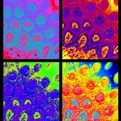 <div><div style="float:left;padding-left:5px;width:70%"><span class=heading><b>Rheumatoid arthritis: the master manipulator?</b> by Kirsty Ross (Strathclyde Institute of Pharmacy and Biomedical Sciences)</span><br />These are false colour images of immune cells called mast cells (black) in mouse tissue. Mast cells are found in inflammed joints during arthritis and could trigger joint destruction. We want to understand when, where and how mast cells affect arthritis. By comparing mice with and without mast cells, it will be possible to work out how mast cells contribute to disease. We would then target them with drugs to help patients.<br /><span class=small>Image: © 2014 Kirsty Ross</span>.  <span class=small>Collaborators: Dr Catherine Lawrence</span></div><div style="float:right;padding-right:5px;"><iframe width="100%" height="166" scrolling="no" frameborder="no" src="https://w.soundcloud.com/player/?url=https%3A//api.soundcloud.com/tracks/153080235&color=ff5500&auto_play=false&hide_related=false&show_artwork=true"></iframe></div></div>