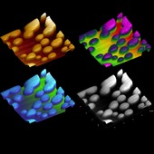 <span class=heading><b>Particles with Protective Properties</b> by Rachel Donaghey</span><br />This is an image of drug-delivering particles which can only be visualised
through the use of a powerful microscope. These small particles have been
developed to trap toxic drugs which will protect patients from immediate and
widespread damage. Adverse drug reactions, such as those associated with
chemotherapeutics, are often debilitating and may even be fatal, however,
particle-based medicines could provide a safe alternative.<br /><span class=small>Image: © 2015 Rachel Donaghey</span>