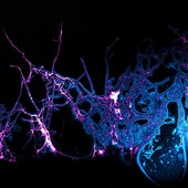 <span class=heading><b>Untangling the Microcosmic Web</b> by Liam Rooney</span><br />Antimicrobial Resistance threatens our ability to treat infections using current antibiotics. Around 70% of antibiotics are produced by web-like Actinomycete bacteria like this one, Streptomyces coelicolor. At Strathclyde, we are developing new ways to image these bacteria to better understand how they produce antibiotics and how they can be used to generate new medicinal compounds.<br /><span class=small>Image: © 2021 Liam Rooney</span>