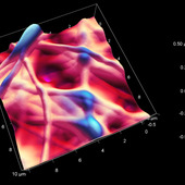 <span class=heading><b>Processing and Characterisation of Medical Polymers for Cardiovascular Applications</b> by Kit Mei Tan (Bioengineering)</span><br /><p class=int>Nearly half of all deaths in Europe is attributable to atherosclerosis, where fatty deposits build up and harden in arteries leading to serious complications such as heart attacks and strokes. Stent deployment is a minimally invasive treatment option that is currently performed for 1 in 100 people in Europe, this procedure however still require improvements in clinical outcomes. Success rates for the treatment can be achieved through further research into the cellular and molecular processes involved and how the materials from which these devices are made are processed. The project aims to construct a physiological model of the blood-vessel wall to study cell-material interactions within a controlled environment, using the technique of electrostatic spinning to produce 3D fibres that mimic the natural fibres found within the blood vessel wall. The proposed model will find application in research programmes for arterial stent design and deployment, drug delivery and pharmaceuticals testing.</p><span class=small>Image: © 2012 Kit Mei Tan</span>