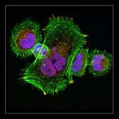 <span class=heading><b>More precious than gold</b> by Lisa McIntosh (SIPBS)</span><br /><p class=int>Gold may seem an odd starting point to develop advanced surface coatings which may provide the next generation of tissue engineering substrates. Although gold alone does not support cell adhesion, its special chemistry facilitates specific orientations of protein ligands which can then mimic more closely the extracellular matrix required for the organisation of tissues. Our image shows human fibroblast cells attached to an entirely synthetic extracellular matrix which, uniquely, has been conformationally defined at the surface by neutron reflectivity. We can now begin to tease apart the importance of ligand orientation, clustering and surface conformation on the extent of cell attachment. Controlling the cellular environment and cellular response has many applications, primarily in tissue engineering and improving the compatibility of implanted medical devices with host tissue. This image is the first step in confirming that entirely synthetic extracellular matrix may function as intended.</p><span class=small>Image: © 2012 Lisa McIntosh</span>.  <span class=small>Christine Whitelaw, Michaela Kreiner, David Blatchford, Chris van der Walle</span>