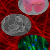 <span class=heading><b>Short peptide hydrogels for cell culture </b> by Vineetha Jayawarna (Pure and Applied Chemistry)</span><br /><p class=int>Aromatic short peptide derivatives, i.e. peptides modified with aromatic groups such as 9-fluorenylmethoxycarbonyl (Fmoc), can self-assemble into self-supporting hydrogels. These hydrogels have some similarities to extracellular matrices due to their high hydration, relative stiffness and nanofibrous architecture [1]. Our research indicates that these short peptide derivatives can be used successfully in 2D and 3D cell culture for different cell types (Chondrocytes, Human dermal Fibroblasts, 3T3, Hepatocytes) and that cell responses can be influenced by chemical and mechanical stimuli [2, 3]. More recently we show that the combined use of thermodynamic and kinetic controlled assembly allows for formation of stable gels with identical chemical building blocks and chemical composition but variable molecular organization, expressing distinctly different morphological and elastic properties. The gels can be differentially assembled to control mesenchymal stem cell fate towards hard (bone) or soft (neural-like, adipose) cell phenotypes in the absence of differentiation media, matrix proteins or bioactive motifs.<br />1. V. Jayawarna et al., (2006) Adv. Mater. 18, 611–614<br />2. V. Jayawarna et al., (2009) Acta Biomaterialia. 9, 5, 934-943.<br />3. M. Zhou et al., (2009) Biomaterials, 2009, 30, 2523-2530.</p><span class=small>Image: © 2012 Vineetha Jayawarna</span>.  <span class=small>Prof. Rein V Ulijn </span>